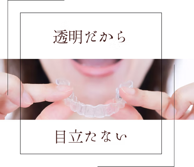 マウスピース矯正アクアシステム 施術例1|きれいに整った歯並び(WhiteBerry新潟)
